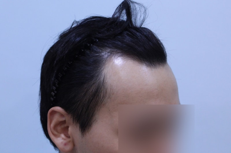 수술전 (1)_1.jpg