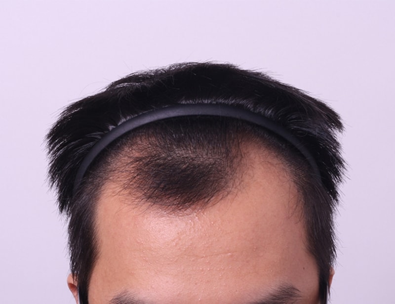 수술전.jpg