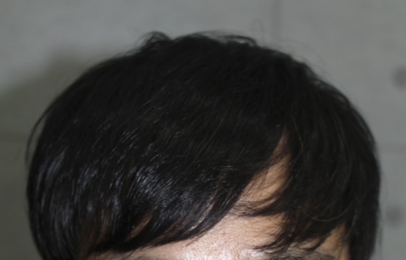 001.png