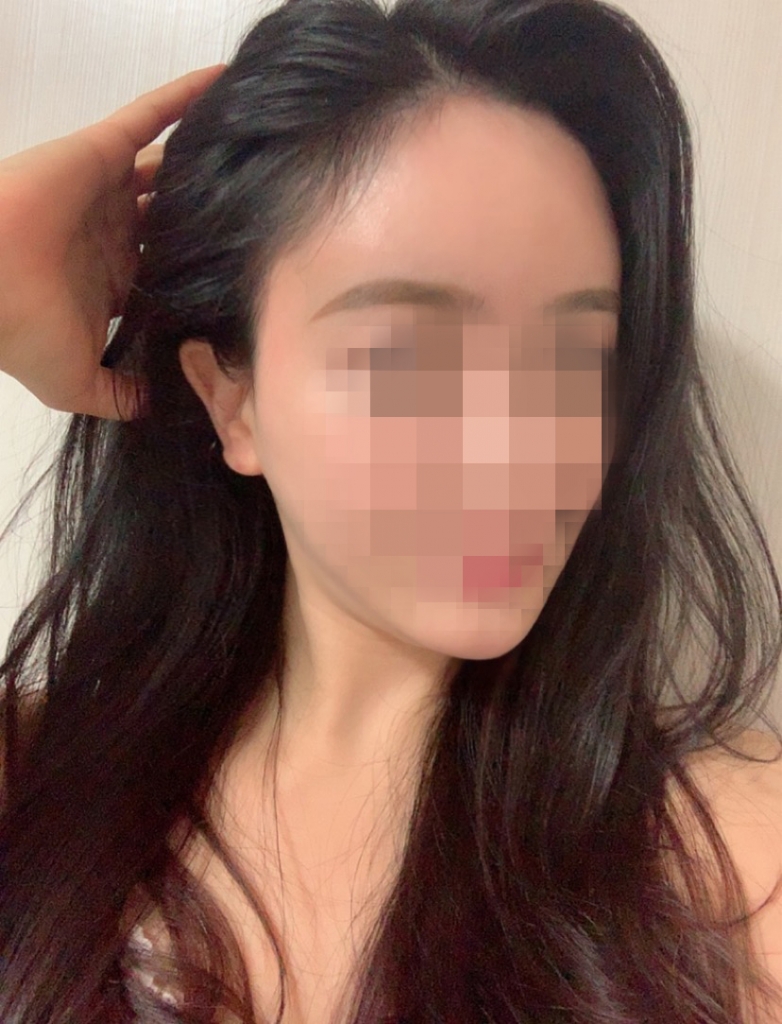 05.이윤주_수술5달.jpg