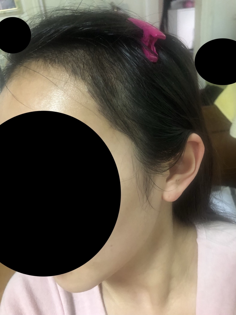 다나 10일차