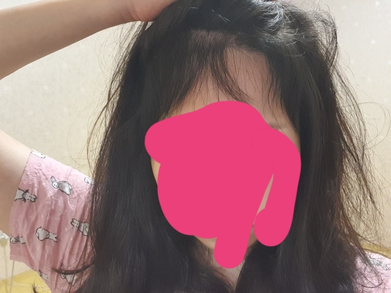 뉴헤어7개월차 입니다