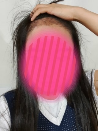 3개월 후, 암흑기 지난듯 합니다.