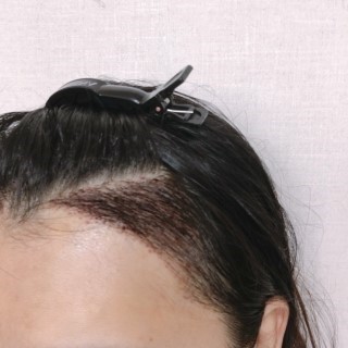 헤어라인 (7).jpg