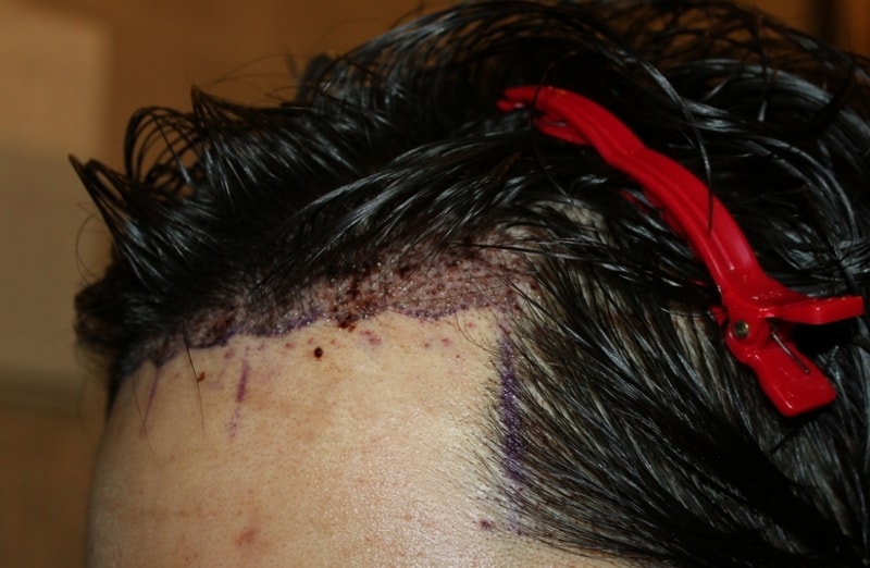 surgery1.jpg
