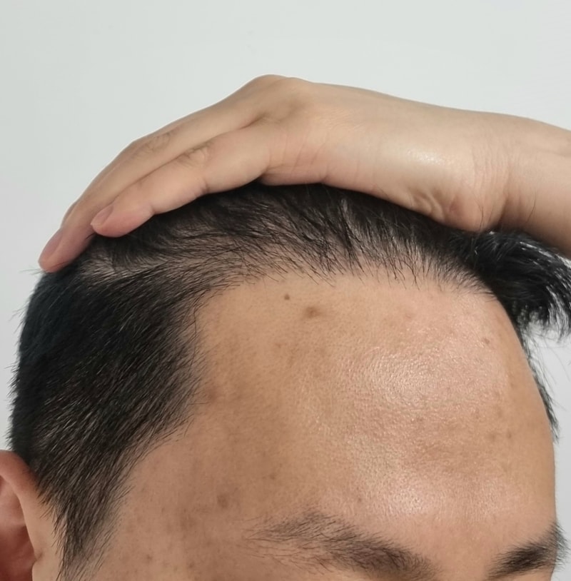 오른쪽.jpg