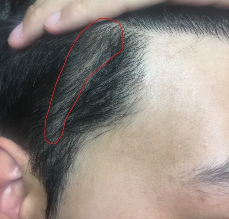 이발할때 밀도맞춰야하는점.jpg