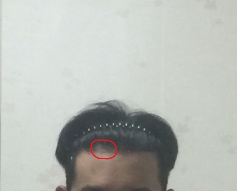 예전에 왼쪽비여보였을때.jpg