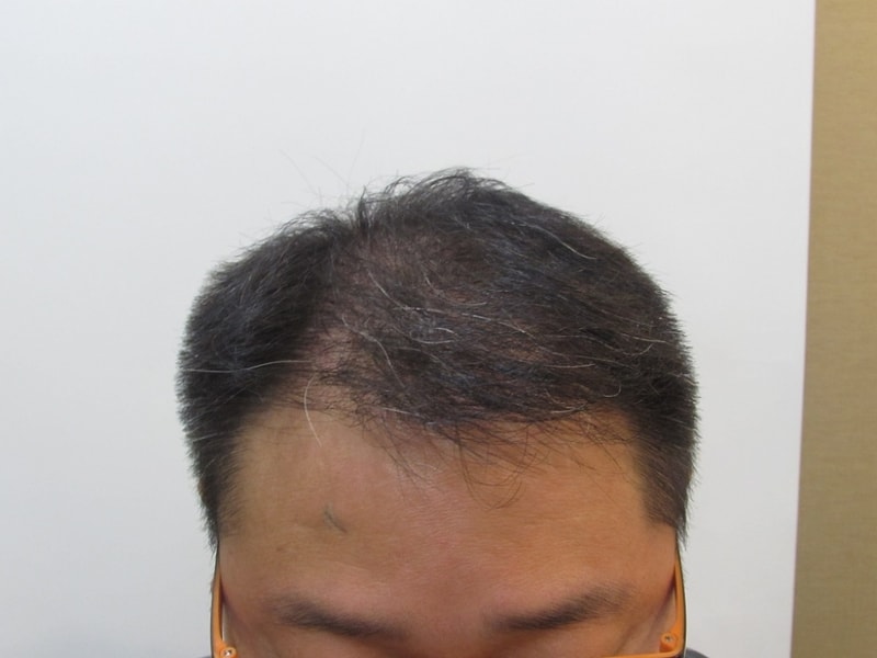 2차 7개월경과.JPG