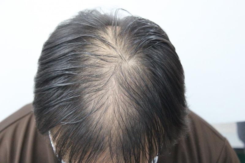 수술전_위.jpg