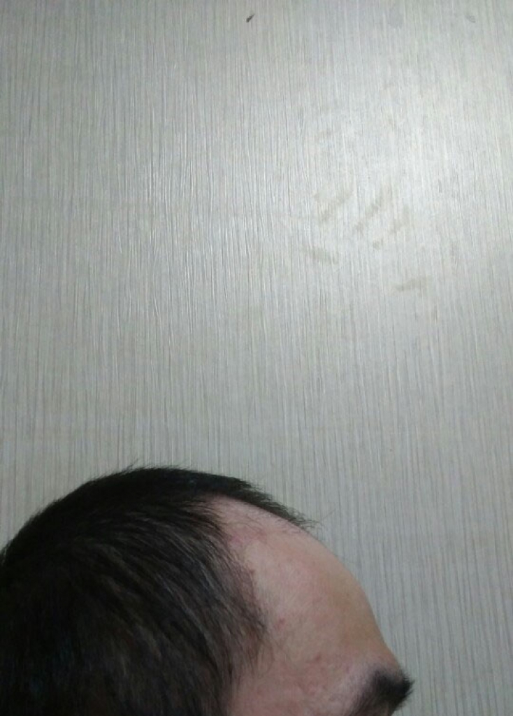 20180816_103239_821.jpg