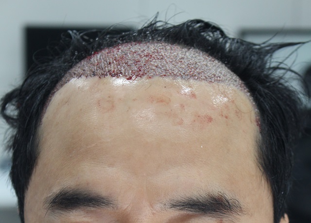 수술날 (2).jpeg