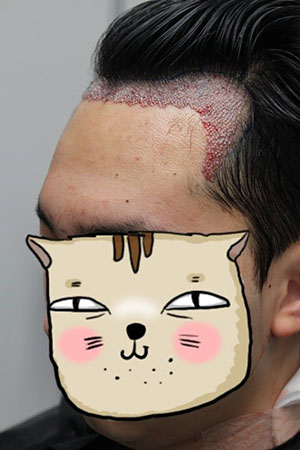 수술받고 왔습니다