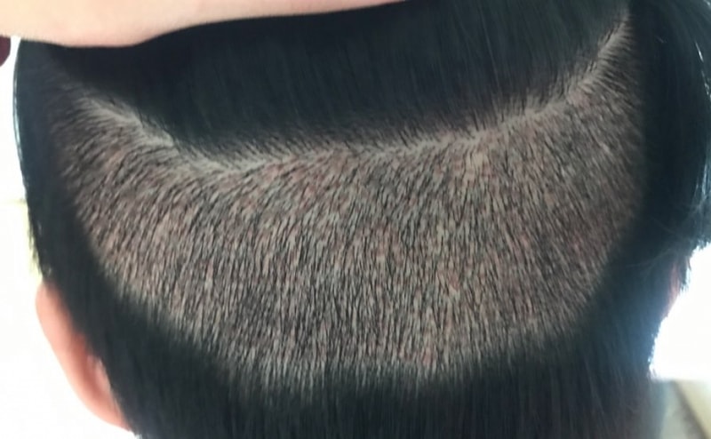 10일차 뒷통수.jpg