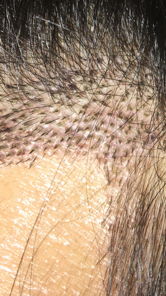 1FA42081-FA4E-4998-86A0-4A747CC8D286.png