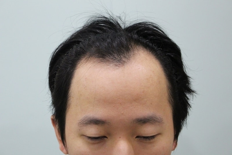 수술전 (1).jpg