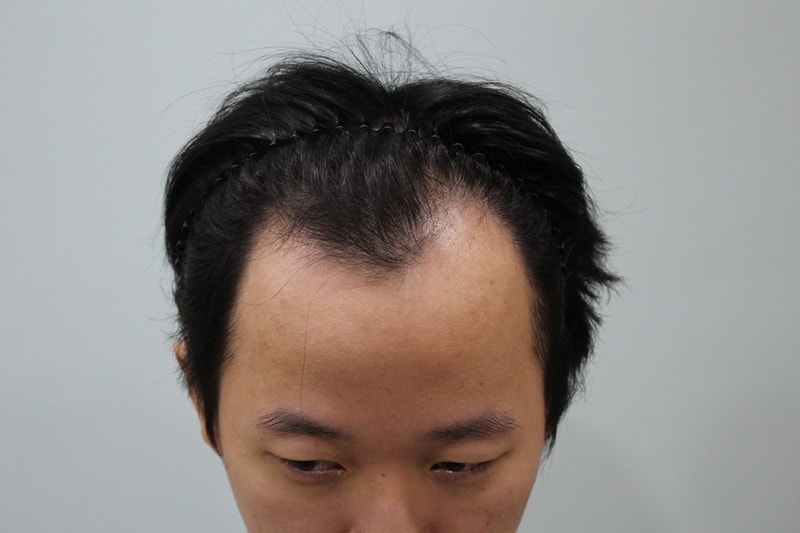 수술전 (2).jpg