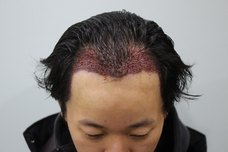 수술직후 (2).jpg