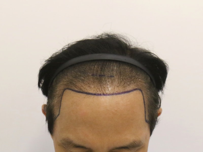 1000029632.jpg