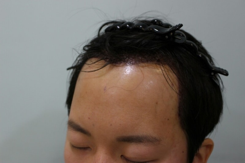 KakaoTalk_20180401_235854772.jpg