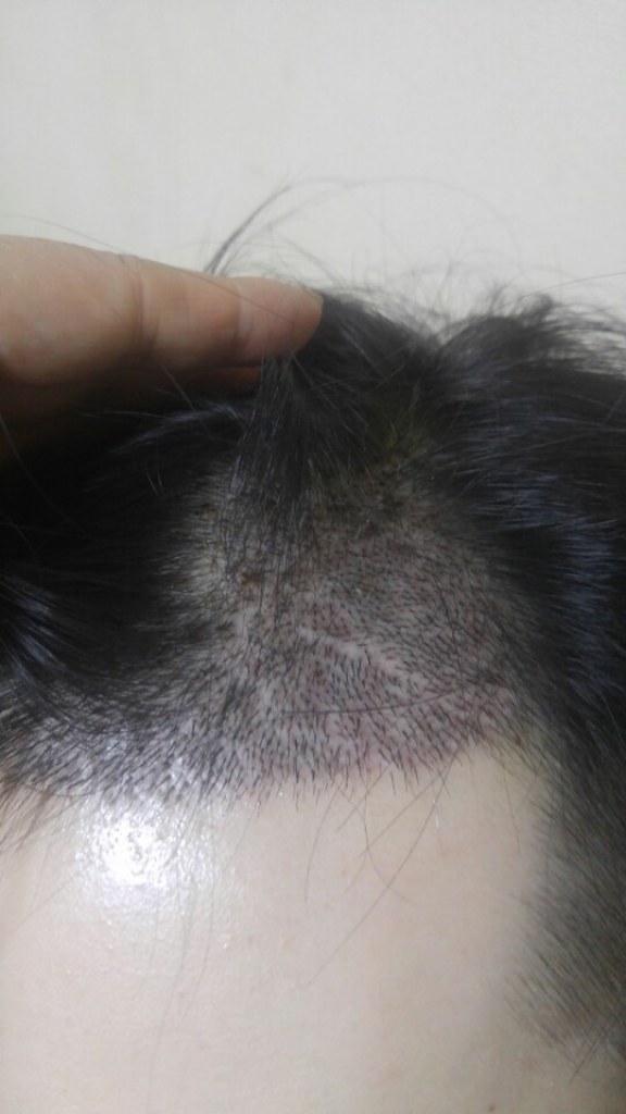 KakaoTalk_20170125_131122143.jpg