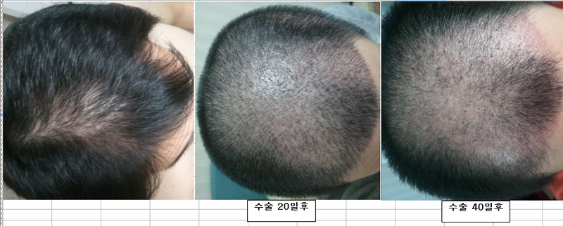 경과사진1.jpg