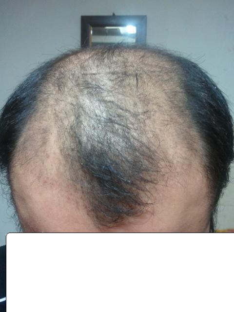 60일후 정면.JPG