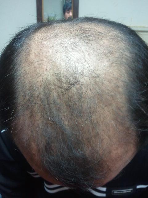 60일후 위머리.JPG