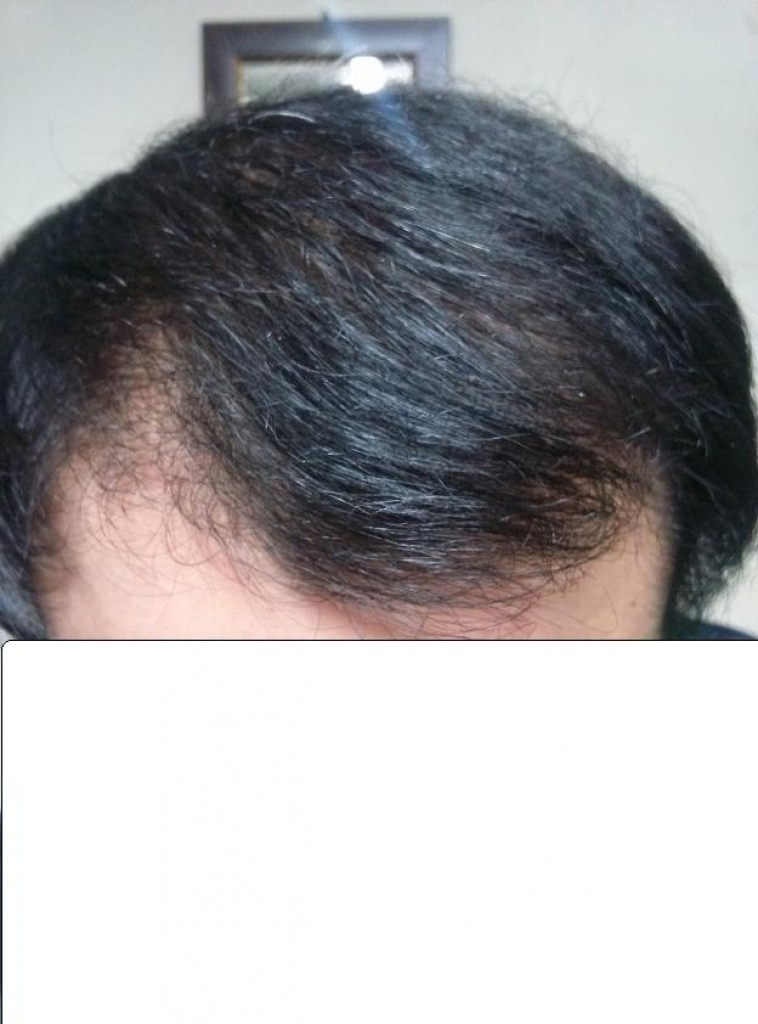 175일 정면 정리.JPG