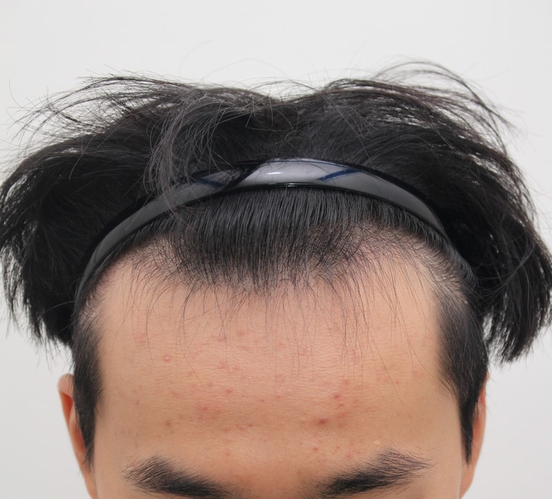 9개월 됐어요