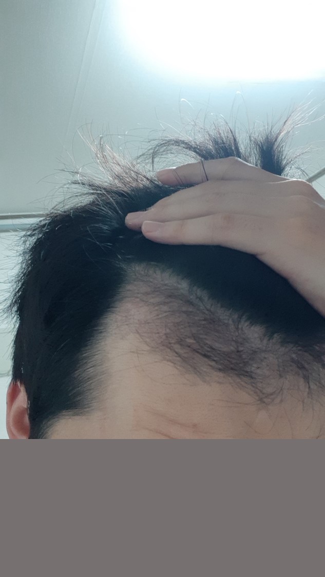 우.jpg