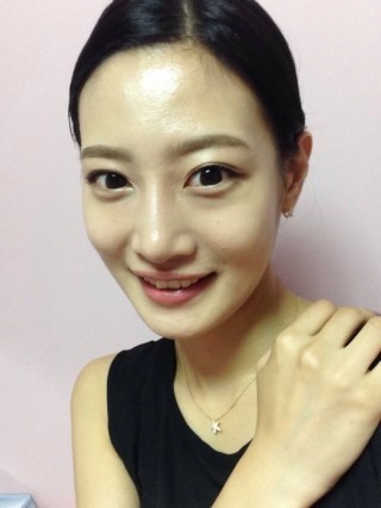 김은영 수술 후 7일.jpg
