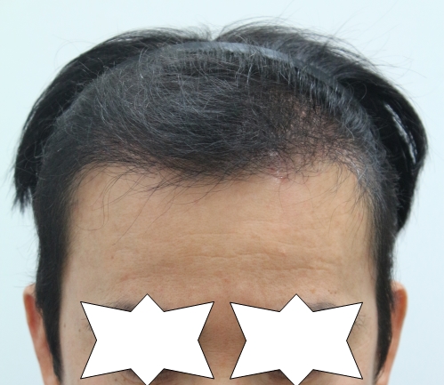 수술후.jpg