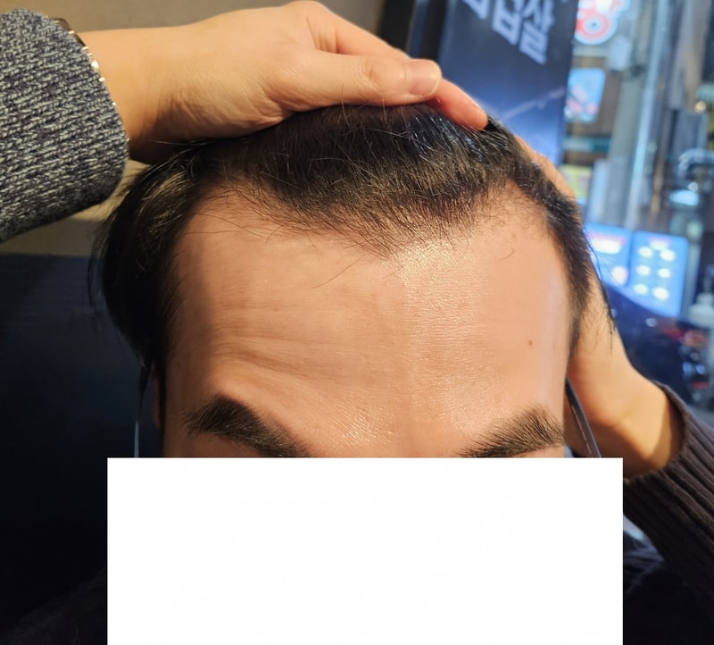 수술 전.jpg