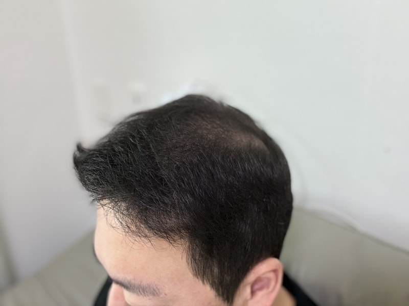 모재성 240일 후