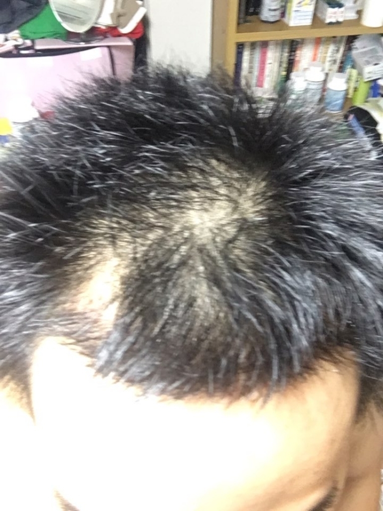 오늘 오른쪽 조명 밝게.jpg