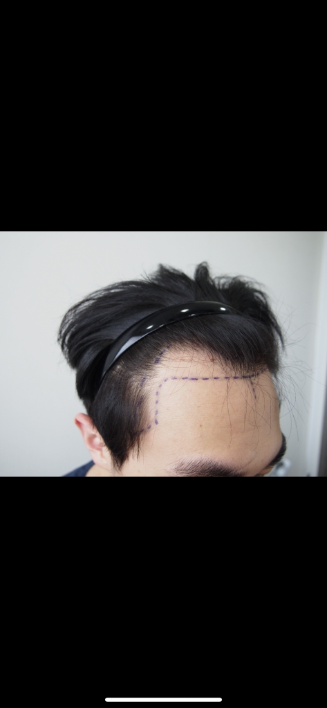 9CBE43E5-811B-48F0-B02E-53D1E88803CC.png