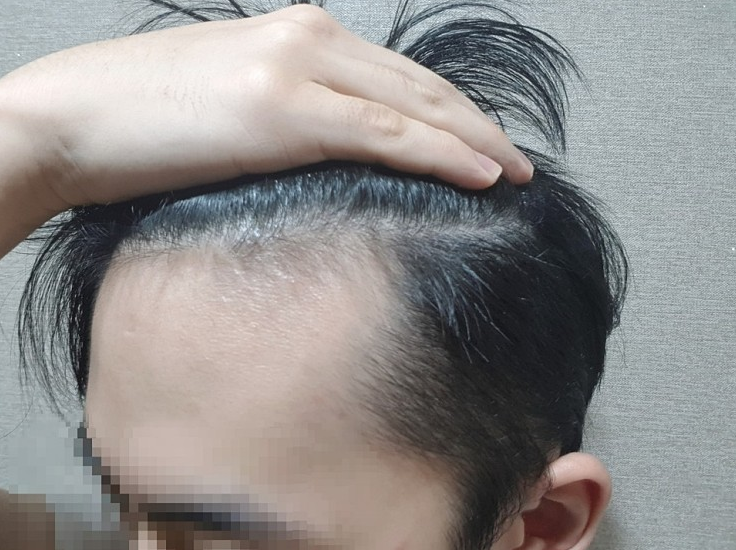 q비포.PNG