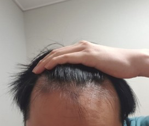 정면.jpg