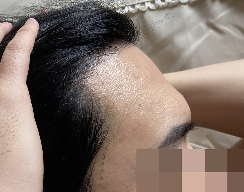 꾸미기김현준_오른쪽_후.jpg