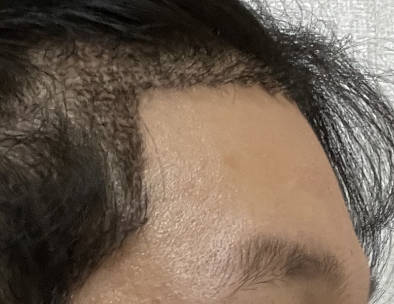 꾸미기홍성민_오른쪽_후.jpg