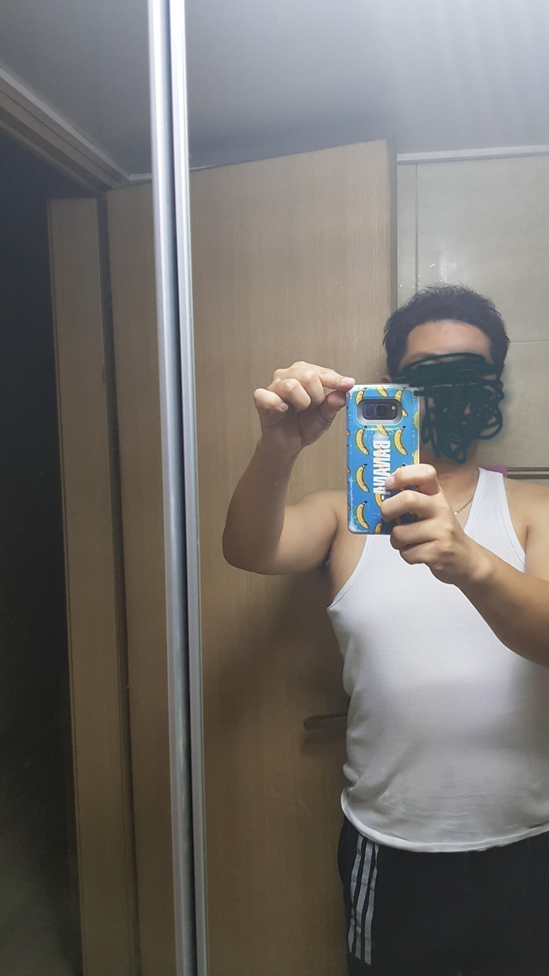 모재성 3천모낭 8개월
