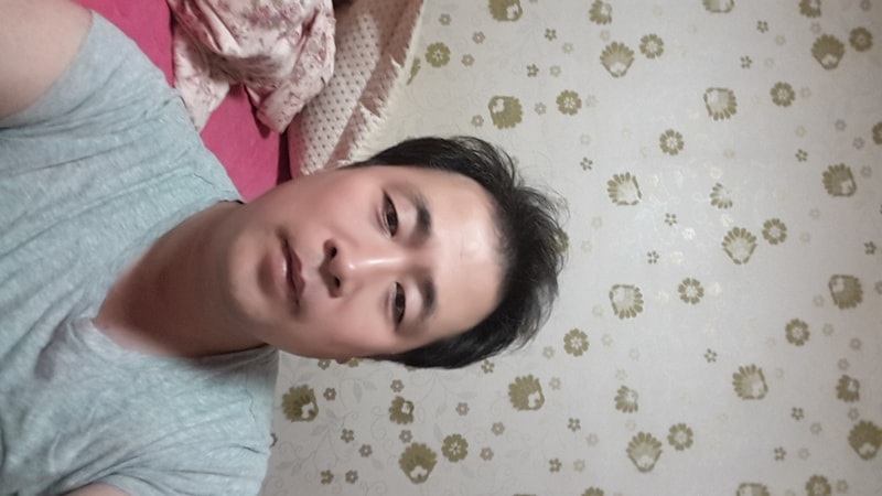 모재성 절개 +비절개 6259모 수술했어요.
