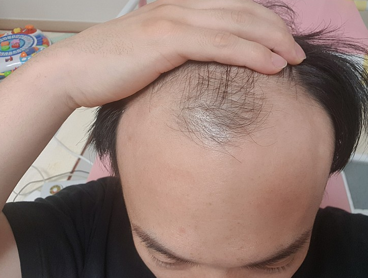 비비비포포포.PNG