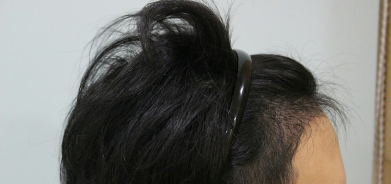 수술후2.jpg