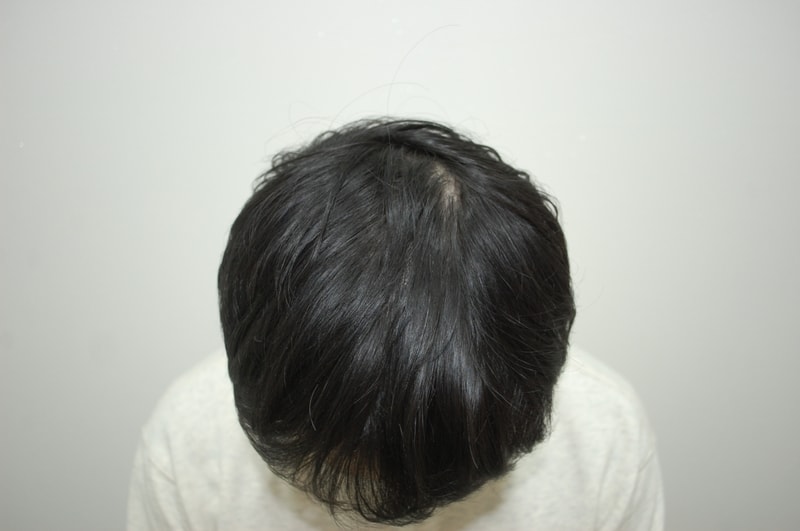 1 수술전2.jpg