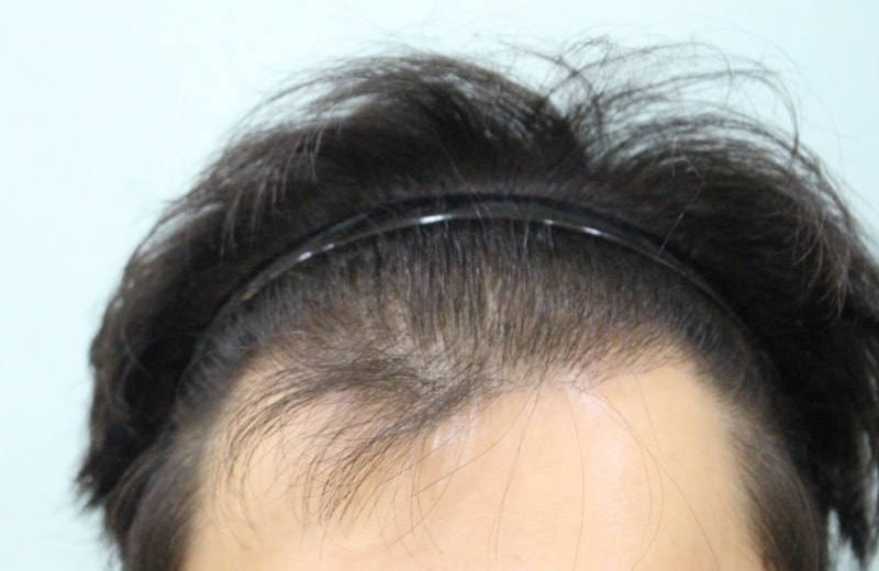 수술전 1.jpg