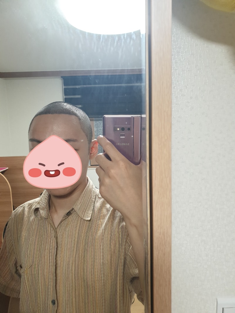 삭발 비절개 m자 옆라인 구렛나루 6일차 후기입니다.