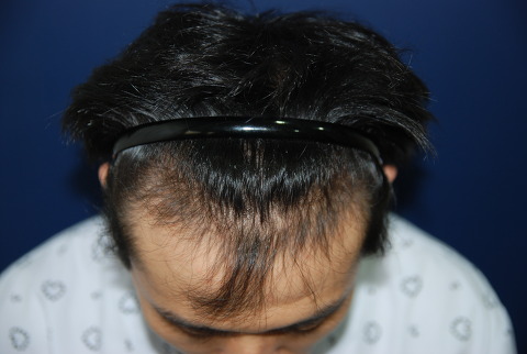 수술전1.jpg