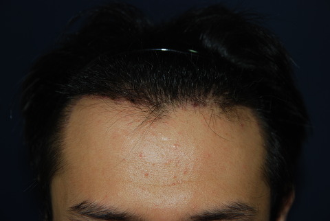 수술후4.jpg